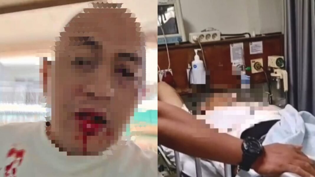Diduga Dijebak, Seorang Pemuda Di Pontianak Mengaku Dikeroyok 8 Orang di Warkop Kartulistiwa Plazza Diduga Dijebak, Seorang Pemuda Di Pontianak Mengaku Dikeroyok 8 Orang di Warkop Kartulistiwa Plazza
